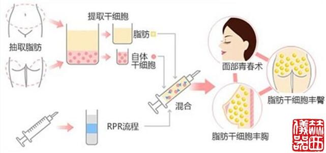 美容離心機